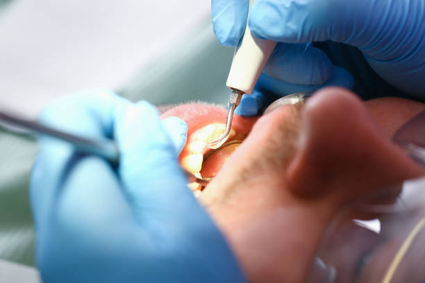 Best Urgent Care for Lost Fillings or Crowns in Hometown, IL