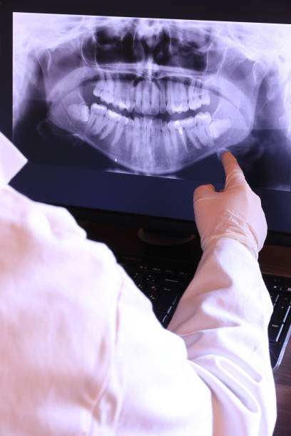 Best Emergency Dental Care for Broken or Chipped Teeth in Hometown, IL